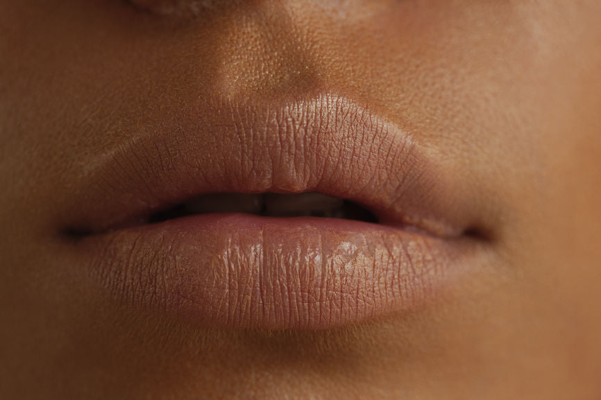 8 Causes Of Chapped Lips And 8 Ways To Prevent Them